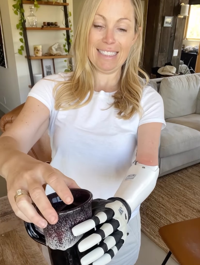 Sarah Herron Reveals How Her Prosthetic Arm Works in New Video: ‘It’s ...